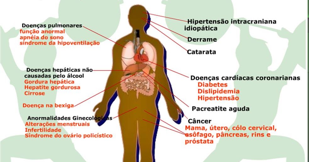 OBESIDADE JUVENIL - ENDOCRINOLOGIA - DR. JOÃO SANTOS CAIO JR ET DRA ...